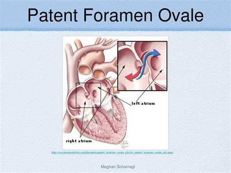 Ppt Fetal Circulation Powerpoint Presentation Free Download Id5388525