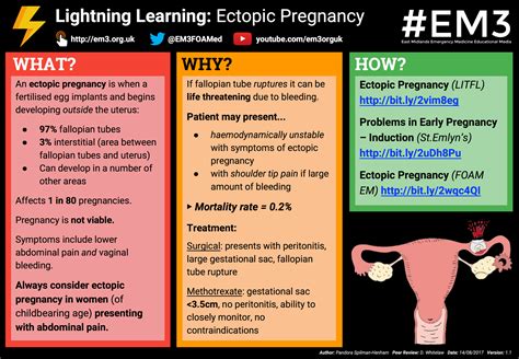Lightning Learning Ectopic Pregnancy EM3