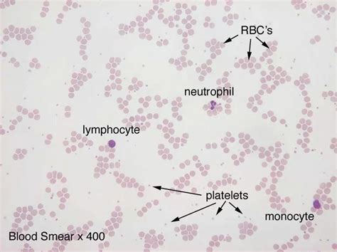Blood Smear Under Microscope Labeled Dulcenferley