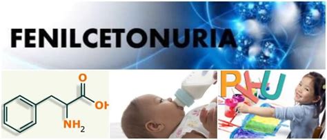 Fenilcetonuria Signos Síntomas Causas Fisiopatología Tratamiento