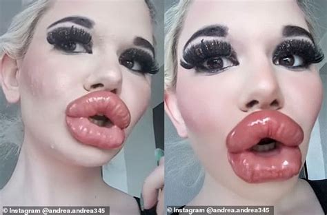 Real Life Barbie With The Biggest Lips In The World Shows Off Huge
