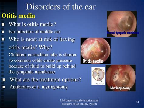 Ppt 304 Functions And Disorders Of The Ear Powerpoint Presentation