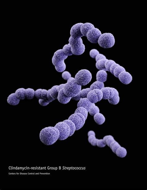 10 Mejores Imágenes De Streptococcus Agalactiae En Pinterest