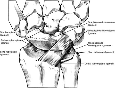 Scapholunate Ligament Repair With Capsulodesis Reinforcement Journal