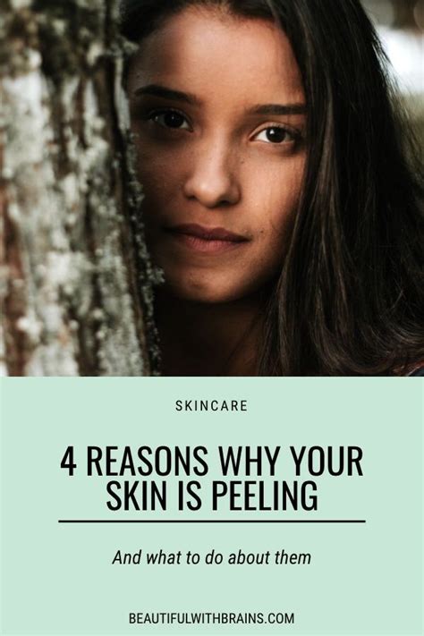 4 Reasons Why Your Skin Is Peeling And How To Fix It Peeling Skin