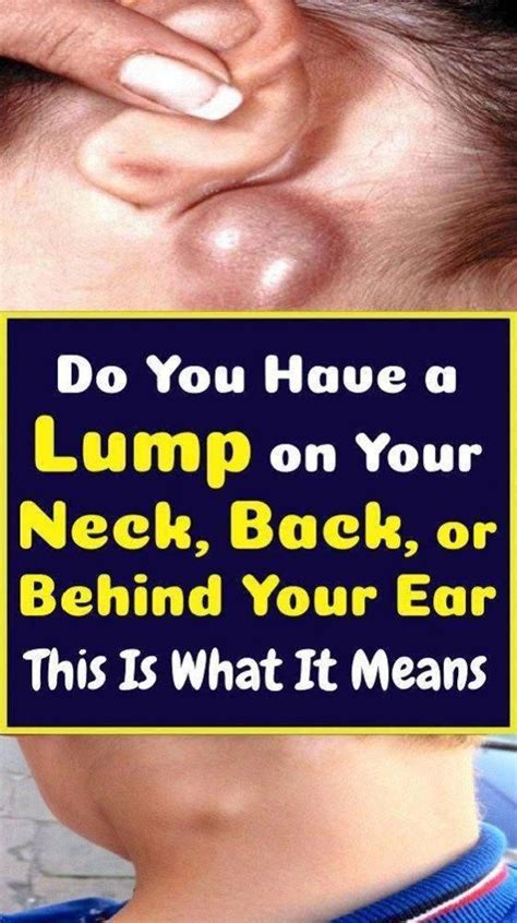 Do You Ve A Lump On Your Neck Back Or Behind Your Ear That Is What It Means