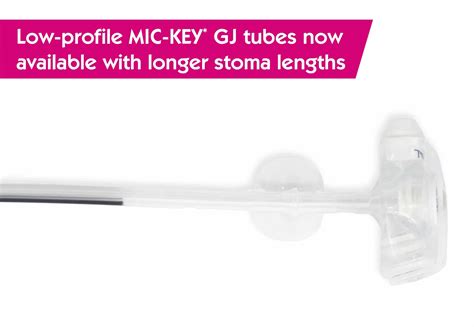 Mic Key Gastro Jejunal Feeding Tube Vygon