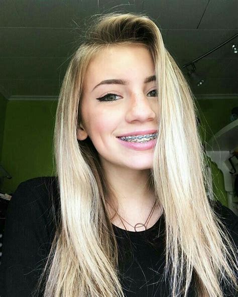 a szent márk gimi cute braces braces girls cute girls with braces