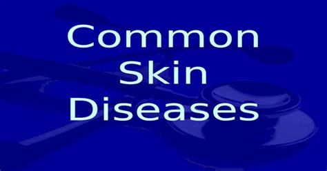 Common Skin Diseases Outline Skin Facts Diseases Of The Skin