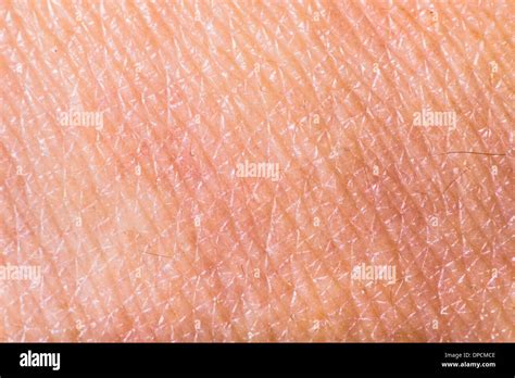 Human Skin Macro Hi Res Stock Photography And Images Alamy