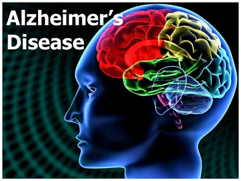 Alzheimers Disease Symptoms Causes And Treatment Santripty