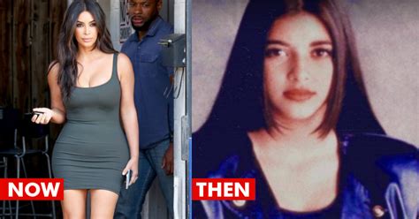 The Transformation Photos Of Kim Kardashian Before And After Surgery Are Unbelievable Rvcj Media