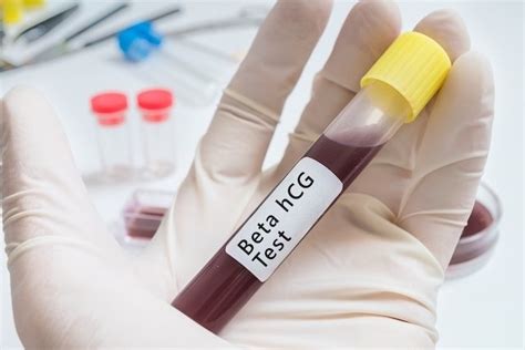 Hcg Test Results Blood Vs Urine And Confirming Pregnancy Tua Saúde
