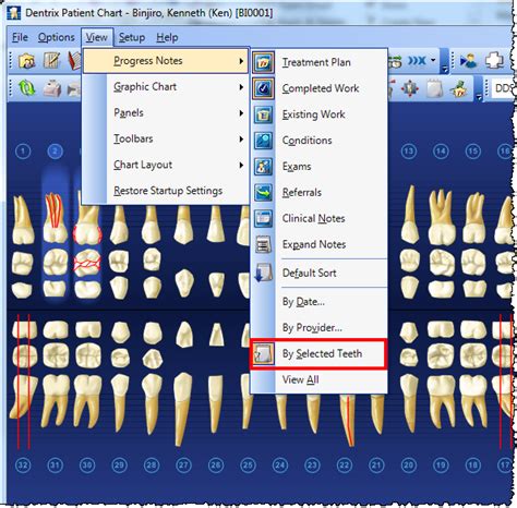 Dentrix Tip Tuesdays Viewing By Selected Teeth In The Patient Chart