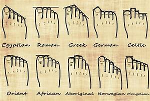 Do You Have Greek Feet Sports And Structural Podiatry Maroochydore
