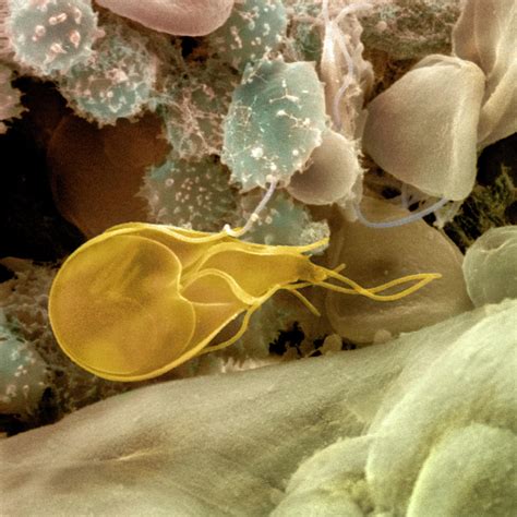 Giardia Lamblia Protozoan Photograph By Dr Tony Brain Science Photo