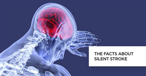 The Facts About Silent Stroke Apollo Hospitals Blog