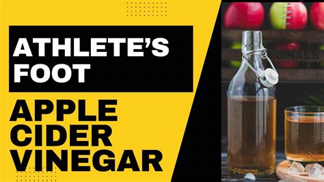 How To Use Apple Cider Vinegar For Athletes Foot Youtube