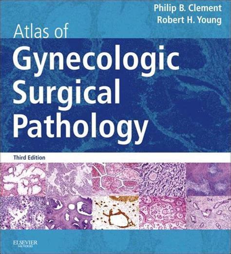 Atlas Of Gynecologic Surgical Pathology E Book Ebook Philip Clement