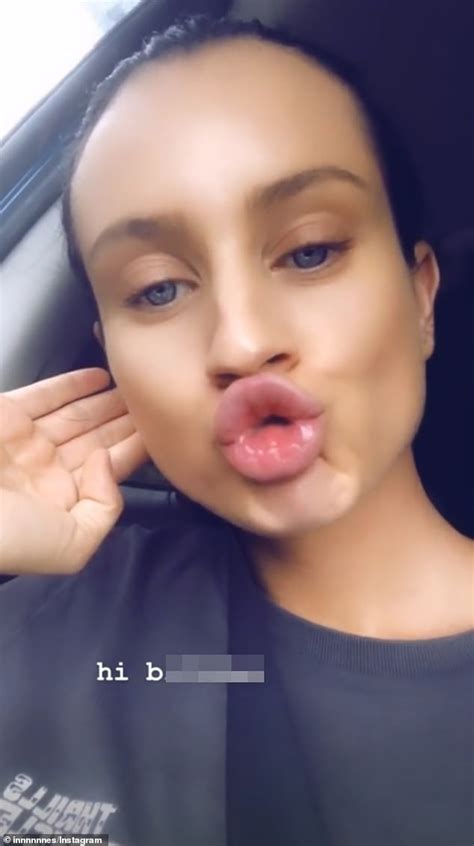 Married At First Sight S Ines Basic Shows Off Her Swollen Pout After Admitting She Gets Fillers