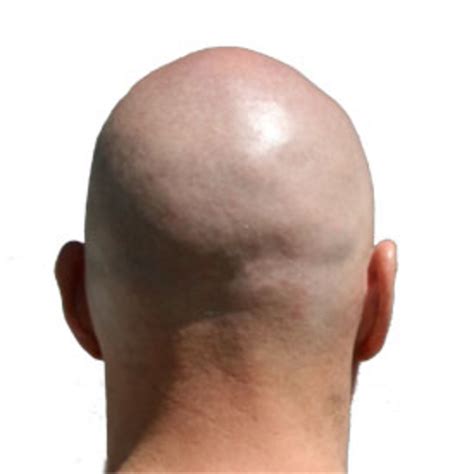 Reasons Being A Bald Guy Rocks Hubpages