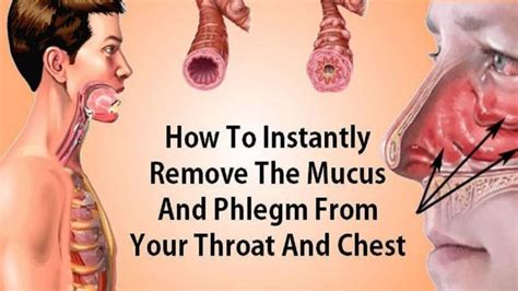 How To Treat Mucus And Phlegm From Your Throat And Chest Instant Result