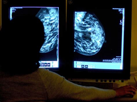 Breast Cancer Screening Error What To Do If You Think You Could Be