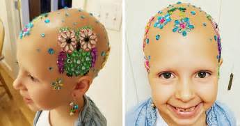 This 7 Year Old Girl Didnt Let Alopecia Stop Her From