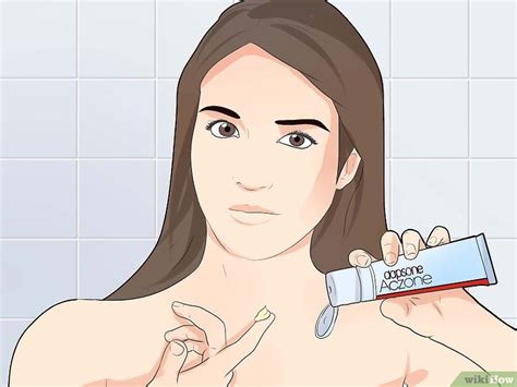 Come Trattare i Brufoli del Cuoio Capelluto - wikiHow