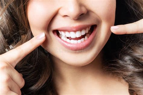 Perfect Healthy Teeth Smile Of A Young Woman Teeth Whitening Dental