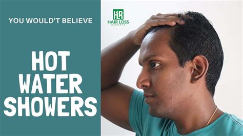 Do Hot Water Showers Cause Hair Loss Hair Loss Reports