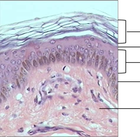 Keratinized Stratified Squamous Epithelium Epidermis
