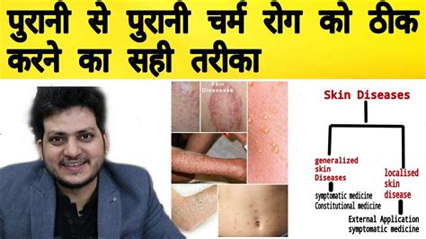 How To Treat Skin Diseases By Homeopathy Way Of Treatment Medicine