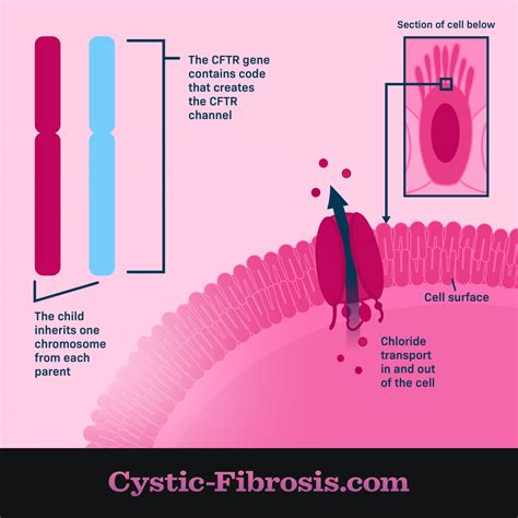 How Does Cystic Fibrosis Develop Cystic