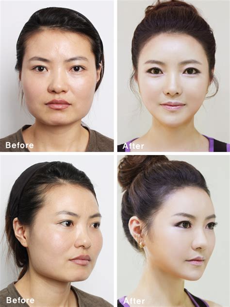 South Korean Plastic Surgery Craze Blamed For Creating Look Alike Miss