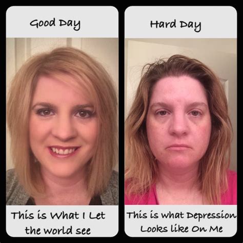 ‘before And After Photo Shows Real Side Of Depression The Mighty