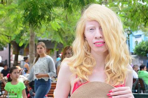 Albino Mexican Model Ruby Vizcarra Embraces Differences Daily Mail Online
