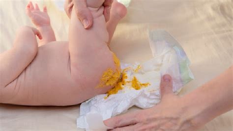 Cómo Saber Si Mi Bebé Recién Nacido Tiene Diarrea Guía Completa ComoPedia