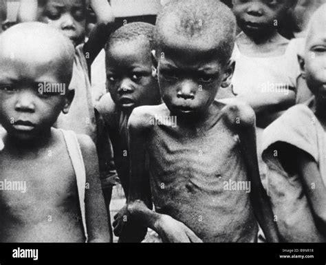 The starving children of Ethiopia Stock Photo - Alamy