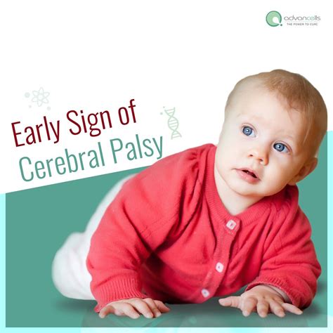 Cerebral Palsy Signs