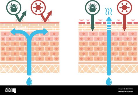 Vista Seccional De La Dermatitis Atópica Y Piel Normal Ilustración