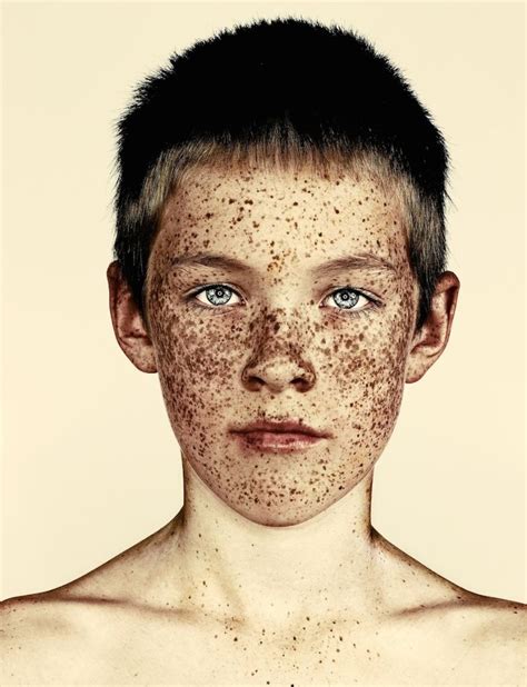 La Beauté Des Tâches De Rousseur Célébrée Dans Une Série Photo Beautiful Freckles Freckles
