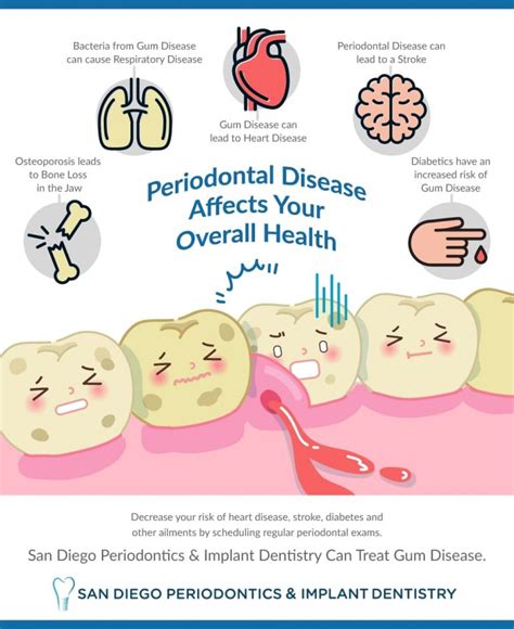 How Periodontal Disease Affects Your Overall Health