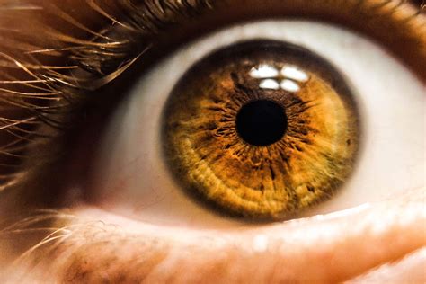 Glaucoma Ocular Tratamiento Y Cirug A Fern Ndez Casas