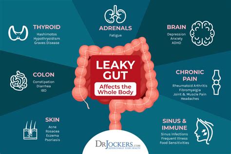 Healing Leaky Gut With Fasting And Liquid Nutrition