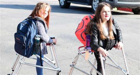 conjoined twins are glad they were cut in half aged four