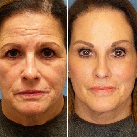 she was detained by border control because of the extremely effective anti aging facial care