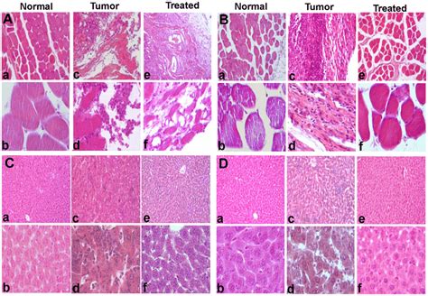 Histopathology Of The Tumor Tissues And Liver Of Mice Following MESB