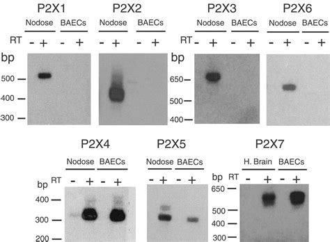 Check spelling or type a new query. P2X purinergic receptor channel expression and function in ...