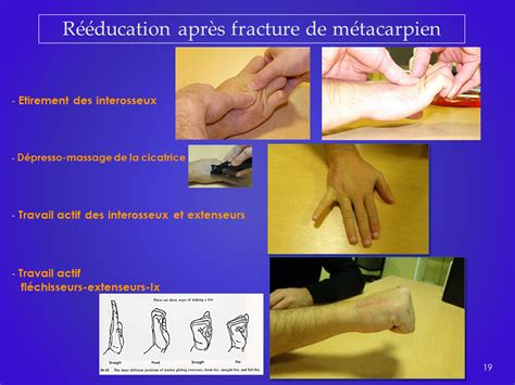 fracture-doigt-reeducation-kinesitherapeute-gerlac-grenoble-echirolles